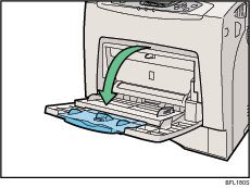 Illustration du bypass