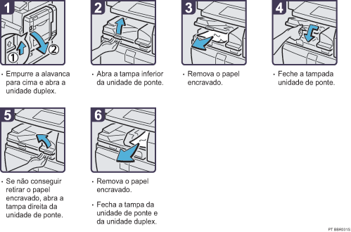 Imagem do procedimento de opera&ccedil;&atilde;o