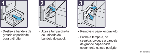 Imagem do procedimento de opera&ccedil;&atilde;o