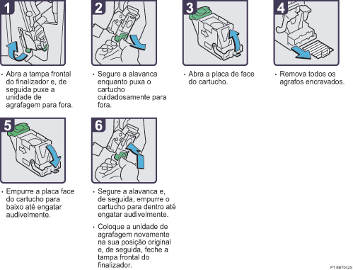 Imagem do procedimento de opera&ccedil;&atilde;o