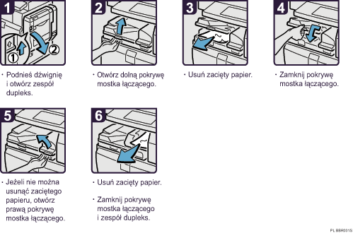 Ilustracja procedury operacji