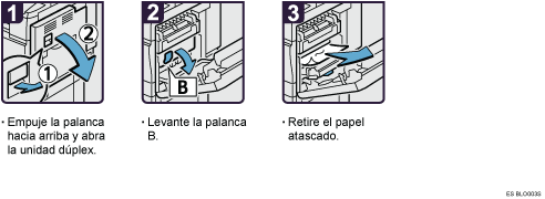 Ilustraci&oacute;n del procedimiento