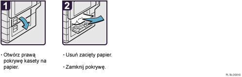 Ilustracja procedury operacji