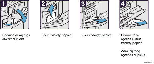 Ilustracja procedury operacji