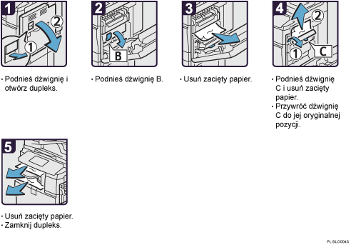 Ilustracja procedury operacji