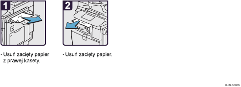 Ilustracja procedury operacji