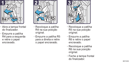 Imagem do procedimento de opera&ccedil;&atilde;o