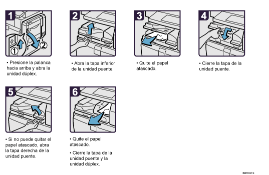 Ilustración del procedimiento
