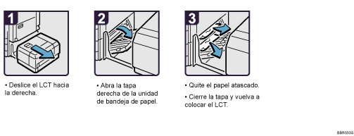Ilustración del procedimiento