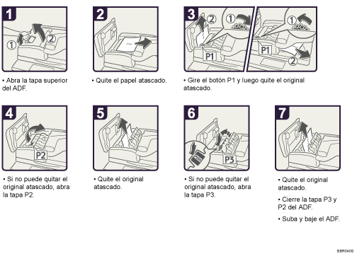 Ilustración del procedimiento