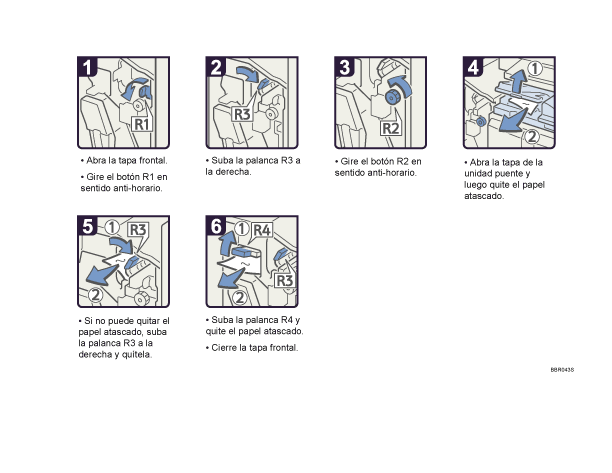 Ilustración del procedimiento