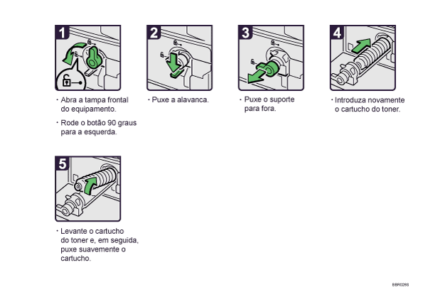 Imagem do procedimento de opera&ccedil;&atilde;o