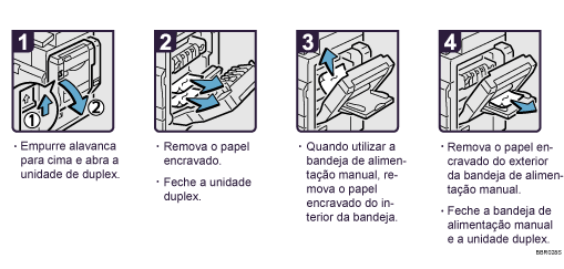Imagem do procedimento de opera&ccedil;&atilde;o