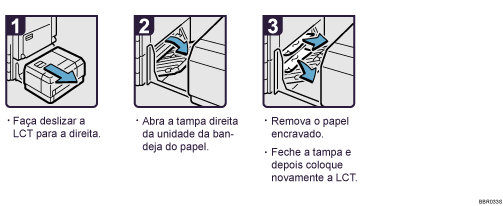 Imagem do procedimento de opera&ccedil;&atilde;o