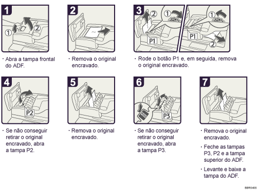 Imagem do procedimento de opera&ccedil;&atilde;o