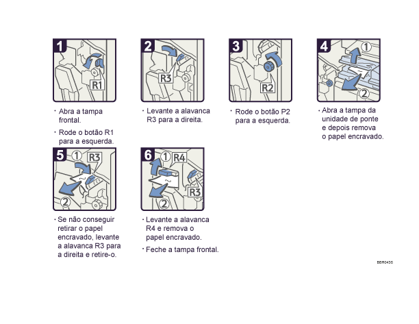 Imagem do procedimento de opera&ccedil;&atilde;o