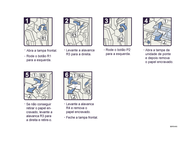 Imagem do procedimento de opera&ccedil;&atilde;o