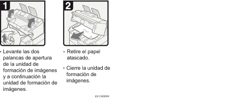 Ilustración del procedimiento