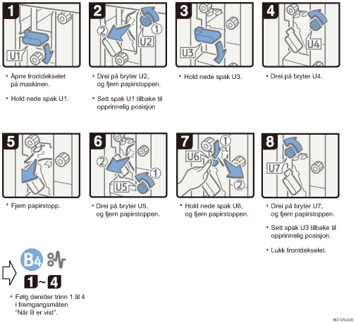 Illustrasjon av operasjonsprosedyren
