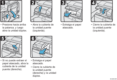 Ilustración del procedimiento