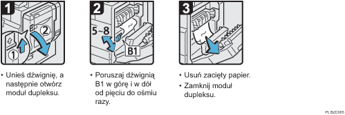 Ilustracja procedury operacji