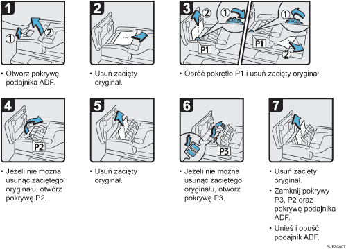 Ilustracja procedury operacji