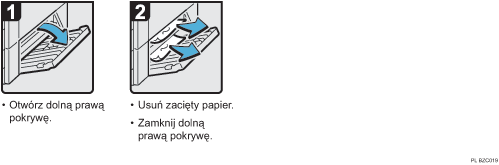 Ilustracja procedury operacji