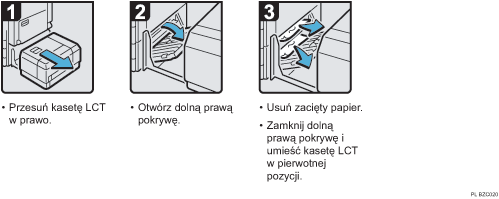 Ilustracja procedury operacji