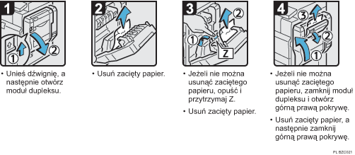 Ilustracja procedury operacji