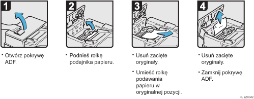 Ilustracja procedury operacji