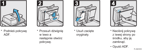 Ilustracja procedury operacji