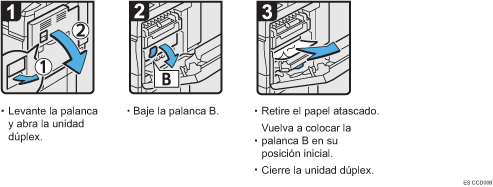 Ilustración del procedimiento