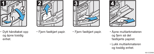 Illustrasjon av operasjonsprosedyren