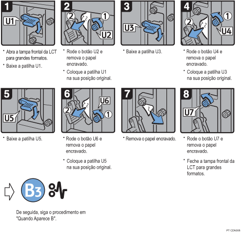 Imagem do procedimento de opera&ccedil;&atilde;o