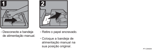 Imagem do procedimento de opera&ccedil;&atilde;o