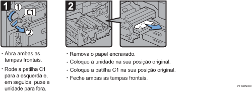 Imagem do procedimento de opera&ccedil;&atilde;o