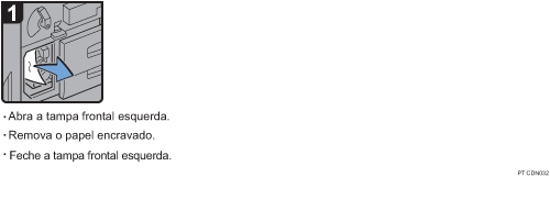 Imagem do procedimento de opera&ccedil;&atilde;o