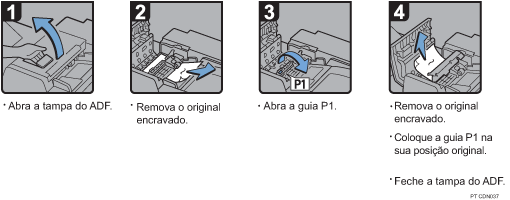 Imagem do procedimento de opera&ccedil;&atilde;o