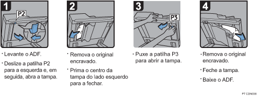 Imagem do procedimento de opera&ccedil;&atilde;o