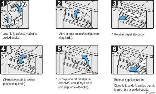 Ilustración del procedimiento