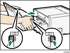 Abbildung des Multi-Bypass