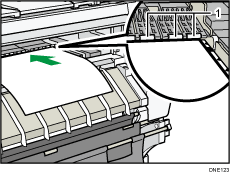 Illustrazione della posizione bypass con didascalie numerate